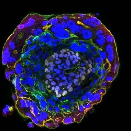 Figure 3:13 day old human embryo. (IMAGE CREDIT: UNIVERSITY OF CAMBRIDGE<br /><br />Human embryos kept alive in lab for unprecedented 13 days so scientists can watch development<br />Human embryos have been kept alive in a petri dish for an unprecedented 13 days, allowing scientists to finally see what happens in the mysterious days after implantation in the womb.<br />www.telegraph.co.uk www.telegraph.co.uk<br /><br /><br /><br />By the 11th day of gestation of a human embryo, for example, being no bigger than the head of a pin yet containing many hundred cells every one of them a living individual in nature. Among these cells, early in the formation of a new life, are the LINE hypothesized Entanglement Cells (EC), some of which are likely visible in this photograph. Entanglement cells are very special cells which together heterodyne their own unique individual entangled states to manifest a new state established at a unique QEF, your QEF. This instantiation manifests a new life; a new emerged LifeID, your position of view (POV), not unlike their own, but at a different unique quantifiable value of the entangled degrees-of-freedom (QEF's) of the immutable entanglement spectrum. This is approximately the stage in the gestation of a viable host where instantiation occurs, the point at which you the individual, become tethered to this particular growing host form and not to some other.<br /><br />Why you? In this there can be no; Why only; How. Via a combination of natural circumstances, some predicted by the LINE hypothesis, this particular host has heterodyned at your QEF. This occurs whether the form is human, or any other viable living form that happens to exist in any temporary, no doubt extinction laden eco-system. The Earth is but one such habitat. This is but one instance of countless such processes of instantiation by natural entanglement that occur second by second throughout existence. By this process, the mobility of individuality is made possible in a vast Higgs universe, together with the non-locality of metamatter and the relativistically unconstrained reach of the entanglement spectrum. These features make individuality and life possible on Earth and anywhere, wherever viable forms happen to emerge, in that place a new instance of life is established whether single or multi-cellular. Empirically proving or disproving the existence and theorized function of the EC and identifying the ubiquitous entanglement molecule which makes this all possible will be greatly facilitated by using subjects that are at this early pivotal stage of development.<br /><br />This initial two-week stage in human gestation, for example, marks the point where the embryo may form one or more hosts (i.e., twins, etc.). Also at this stage, the characteristic central structure of the host form begins to emerge. It is very likely that the EC are present but have not yet heterodyned at this juncture. At this stage, the embryo remains a collection of distinct individual cells each with a specific or soon to be determined mission. Once the EC combine their individual entangled states to establish the one or more new emerged entangled states and the POV's defined therein, an equal number of new instances of individuality come into existence perhaps for the first time, or perhaps not for the first time. The one certainty in this process is that this particular host has never before existed and never will again.<br /><br />Further, we may inquire; at what stage in its evolution does an emerged species gain its EC and go from being a colony of individual cells, to become an emerged form hosting a position of view with a unique emerged QEF? To understand this, it would help to seek living forms representative of each evolutionary stage of development. Species that straddle the evolutionary line between a colony of living individual cells and an emerged living being with a POV distinct from its other non-EC's. Such species no doubt exist but are not easily categorized. For some reason, evolution seems to favor full emergence once a colony develops the EC, like a switch being flipped. This is not to suggest that such recently emerged species would immediately possess highly integrated systems like a central nervous system which links its disparate regions of specialization. Such complex features would take time to evolve but the QE connection to metamatter had by all living forms requires no such embellishments.<br /><br />Also, how might a species respond evolutionarily to developing a newly established POV as compared to being a colony of living individuals? This would be a truly fascinating study to undertake. The LINE hypothesis suggests that imprinted metamatter influences evolution throughout this universe in ways that should not be underestimated and may very well play a crucial role in disseminating this amazing capability to eco-systems separated by distances that are otherwise physically unbridgeable. Thus, like all other features of the cell, the capability to combine the natural entangled state first evolves in cells which then further specialize. Thereby passing on their newly acquired talents to offspring. Together these new EC perform the initial combination of their individual QE connections to establish the new emerged individuals position of view thereby marking the emergence of a new host form for emerged individual life, a new species.<br /><br />From an evolutionary standpoint, one may be tempted to expect a dramatic transformation to accompany the transition from the collection to the emerged host, but this is unlikely to be the case. More probable is a slow evolution out of the hitherto normal behavior of that particular colony as new possibilities slowly take hold of its evolutionary trajectory. Thus the cloud-storage repository of newly entangled metamatter further shapes the destiny of a new species. The science which describes POV evolution will, like all aspects of living biology, be deep and complex in its own right. The evolution of a species has many influences and likely goes stepwise with the evolution of its POV as both number and complexity of EC may evolve.<br /><br />So if you, whatever your species, are impressed and proud of the evolved capabilities of your living form, it is well and good that you should be, but also realize that none of those known features can be considered to be more impressive than the feature of natural entanglement heterodyning evolved in the EC. This remarkable feature permits nothing less than the establishment of complex emerged beings, like you, in this universe. If not for this amazing feature of the cell only individual cells and colonies thereof would populate the Earth. This is not to suggest what forms such colonies might take, but the distinction between a colony of individual cells and an emerged being such as a human or a millipede or a finch is significant and important. Today science defines no clear basis for such a distinction, the LINE hypothesis does.